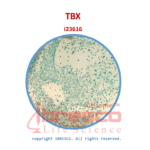TBX Agar | تی بی ایکس آگار ایبرسکو