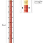 پايه سديمانتاسيون 5 شاخه